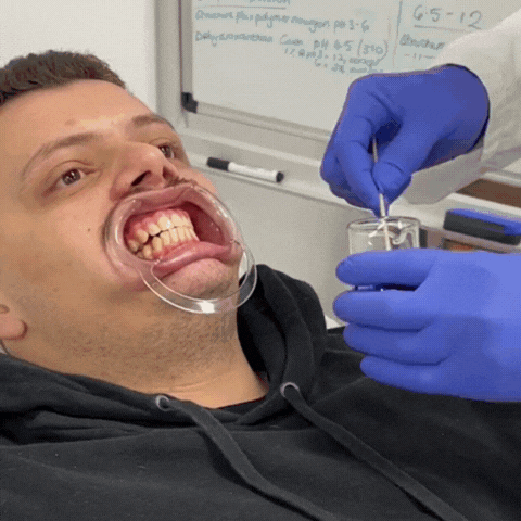 Creme dental clareador HiSmile | pasta de dente para clareamento creme dental Mil e Dois Descontos 